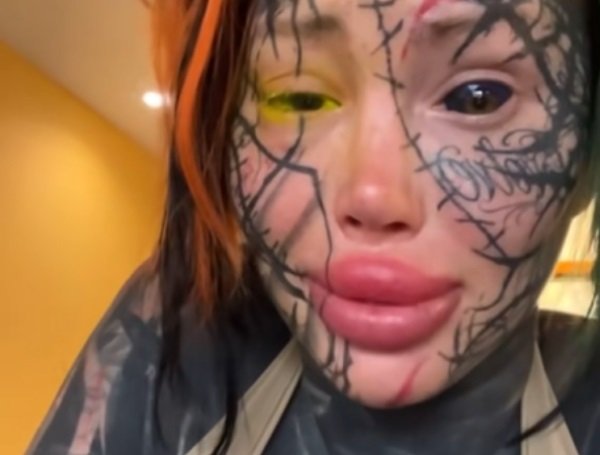 Modelo casi pierde su ojo izquierdo tras tatuárselo de amarillo para parecer una “diosa de otro mundo”