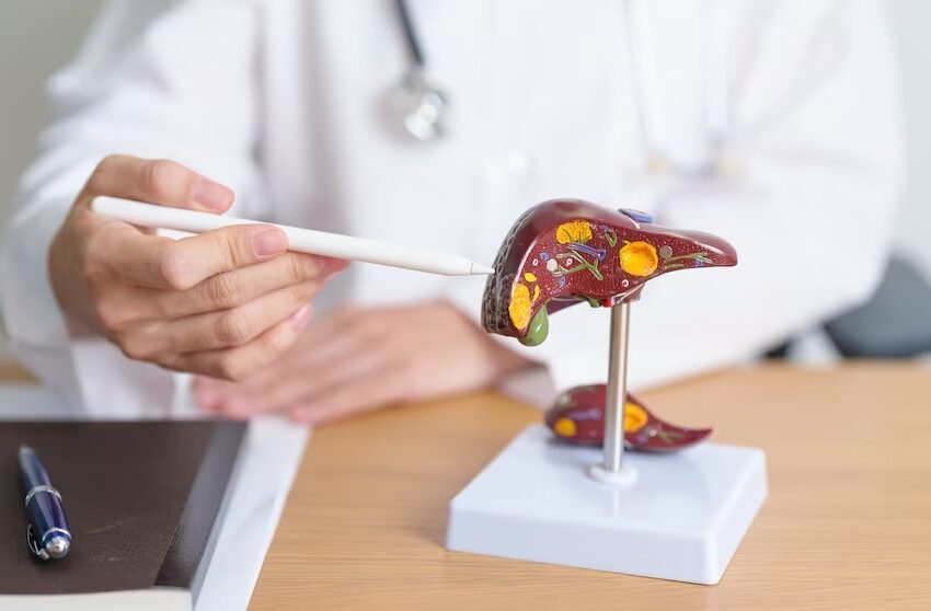  Este alimento puede beneficiar el hígado graso y ayudar a prevenir enfermedades hepáticas, según especialistas